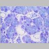 Pancreas SF 13.jpg